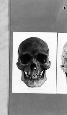 Cráneo humano, vista frontal, reprografía