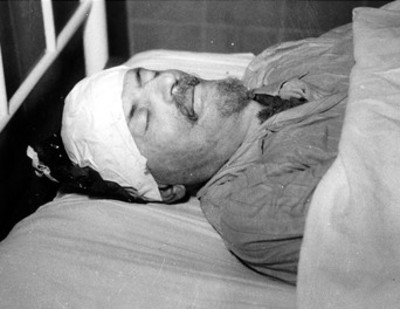 Cadáver de León Trotsky en el hospital