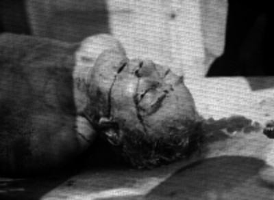 Cadáver de un hombre sobre una plancha